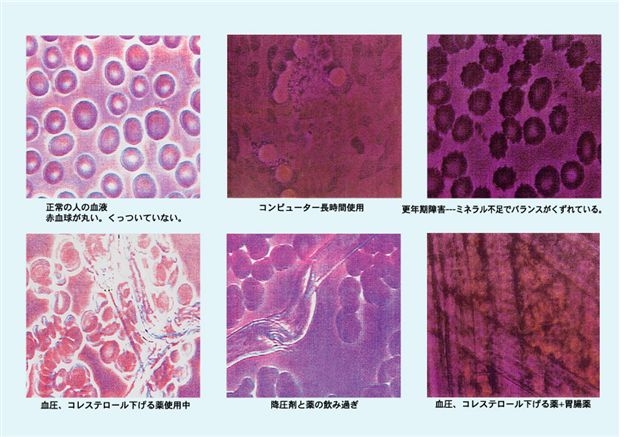 血液画像